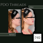 PDO Threads (1080 x 1080 px) - 5